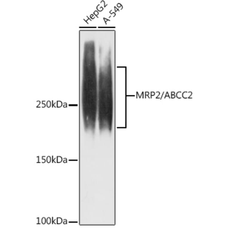 Western Blot - Anti-MRP2 Antibody [ARC1619] (A305508) - Antibodies.com