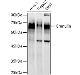 Western Blot - Anti-Granulin Antibody [ARC51129] (A305510) - Antibodies.com