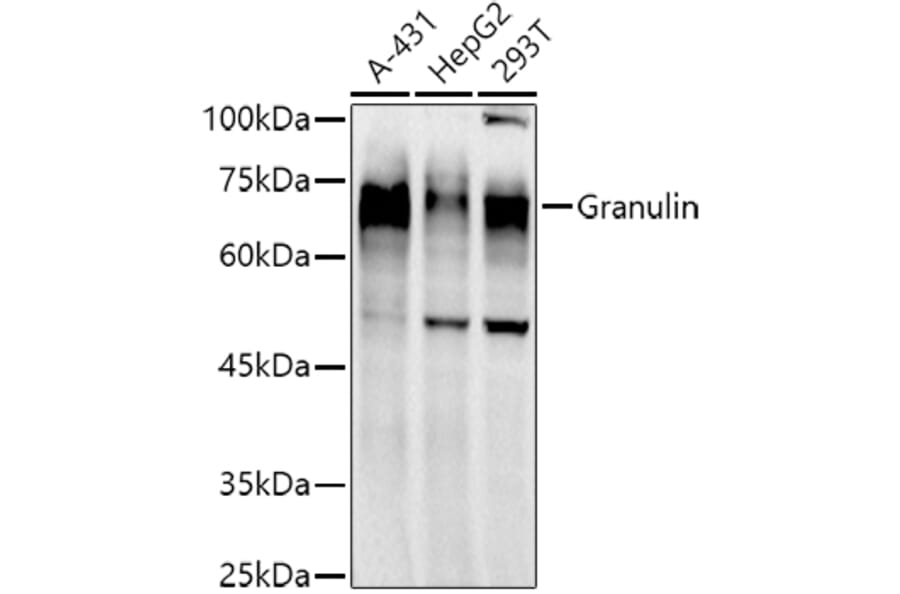 Western Blot - Anti-Granulin Antibody [ARC51129] (A305510) - Antibodies.com