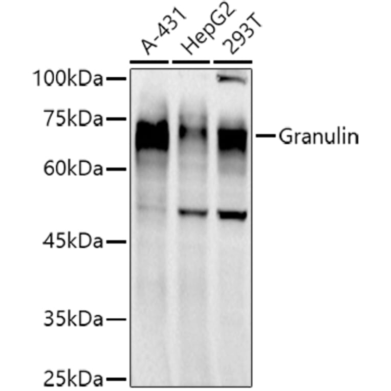 Western Blot - Anti-Granulin Antibody [ARC51129] (A305510) - Antibodies.com