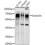 Western Blot - Anti-Granulin Antibody [ARC51129] (A305510) - Antibodies.com