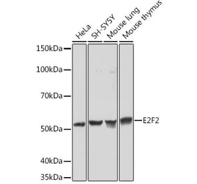 Western Blot - Anti-E2F2 Antibody [ARC1940] (A305511) - Antibodies.com