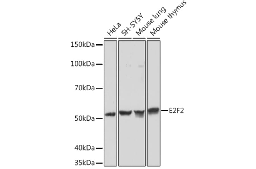 Western Blot - Anti-E2F2 Antibody [ARC1940] (A305511) - Antibodies.com