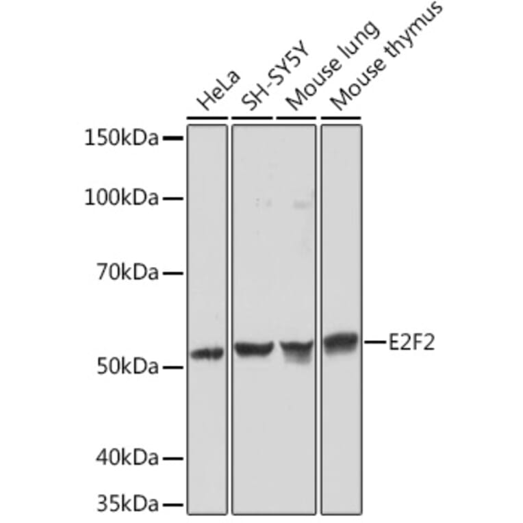 Western Blot - Anti-E2F2 Antibody [ARC1940] (A305511) - Antibodies.com