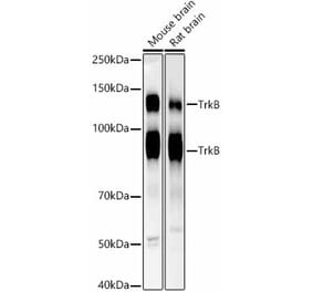Western Blot - Anti-TrkB Antibody [ARC53486] (A305512) - Antibodies.com