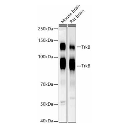 Western Blot - Anti-TrkB Antibody [ARC53486] (A305512) - Antibodies.com