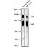 Western Blot - Anti-TrkB Antibody [ARC53486] (A305512) - Antibodies.com