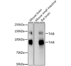 Western Blot - Anti-TrkB Antibody [ARC53483] (A305513) - Antibodies.com