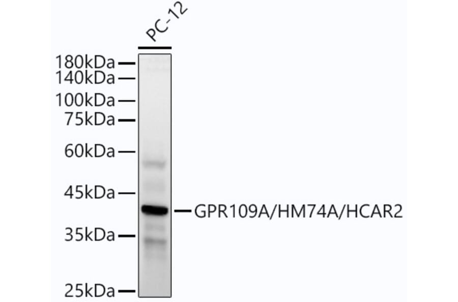 Western Blot - Anti-Puma gamma/GPR109A Antibody [ARC54160] (A305514) - Antibodies.com