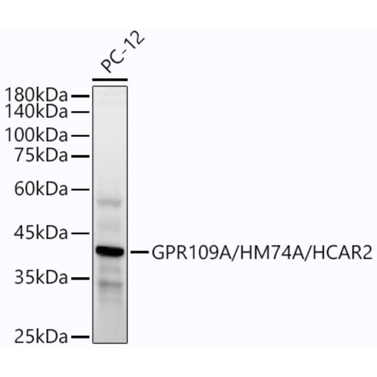Western Blot - Anti-Puma gamma/GPR109A Antibody [ARC54160] (A305514) - Antibodies.com