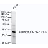 Western Blot - Anti-Puma gamma/GPR109A Antibody [ARC54160] (A305514) - Antibodies.com