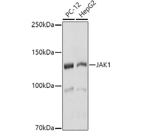 Western Blot - Anti-JAK1 Antibody (A305516) - Antibodies.com