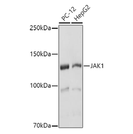 Western Blot - Anti-JAK1 Antibody (A305516) - Antibodies.com