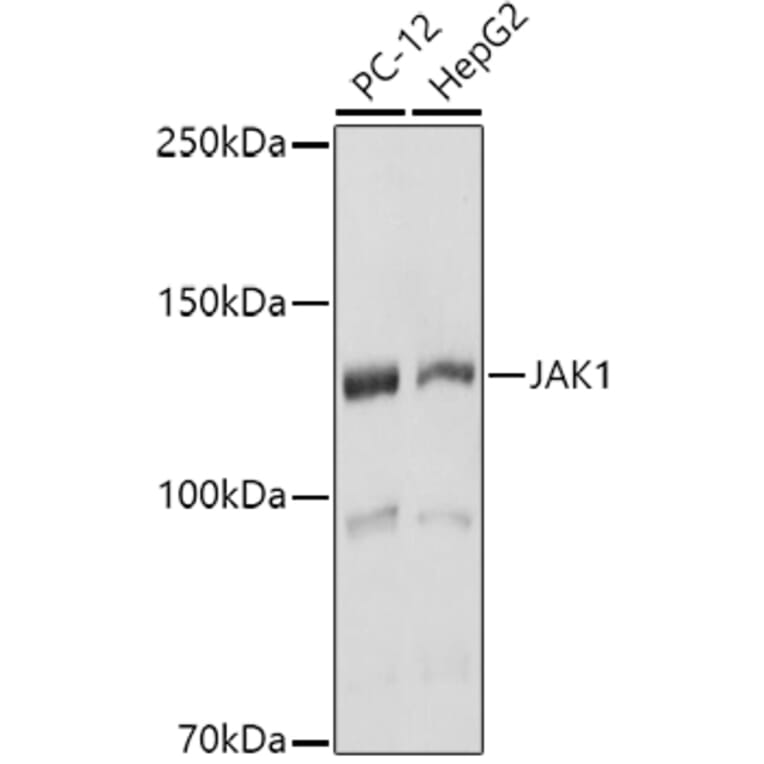 Western Blot - Anti-JAK1 Antibody (A305516) - Antibodies.com