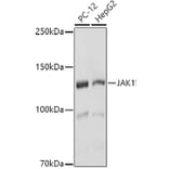 Western Blot - Anti-JAK1 Antibody (A305516) - Antibodies.com