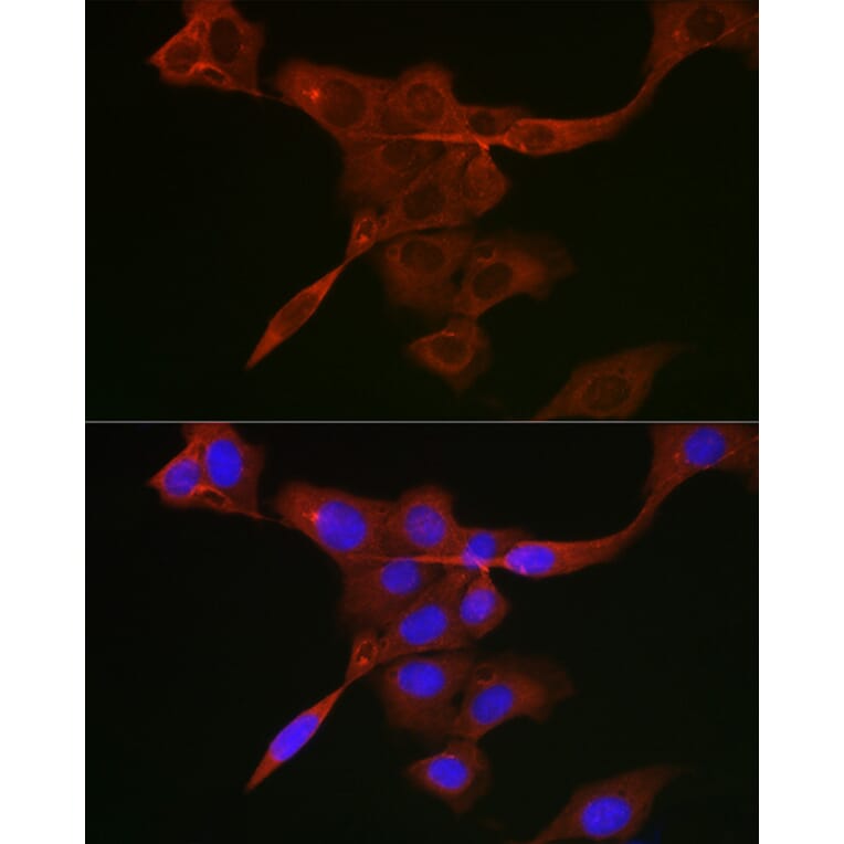 Immunofluorescence - Anti-JAK1 Antibody (A305516) - Antibodies.com