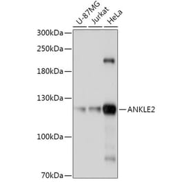 Western Blot - Anti-ANKLE2 Antibody (A305517) - Antibodies.com