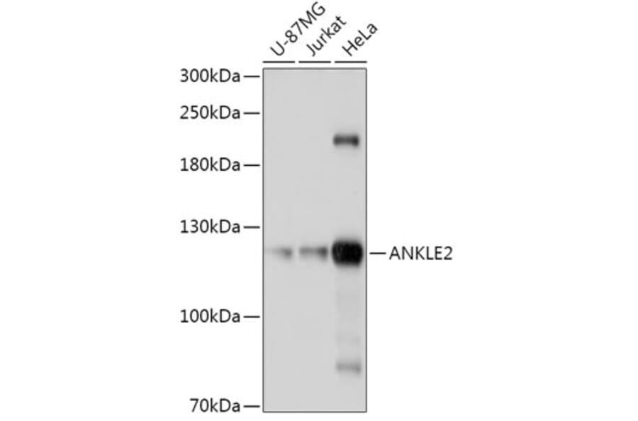 Western Blot - Anti-ANKLE2 Antibody (A305517) - Antibodies.com
