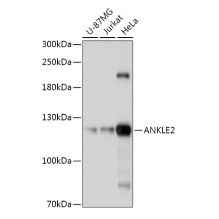 Western Blot - Anti-ANKLE2 Antibody (A305517) - Antibodies.com