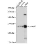 Western Blot - Anti-ANKLE2 Antibody (A305517) - Antibodies.com