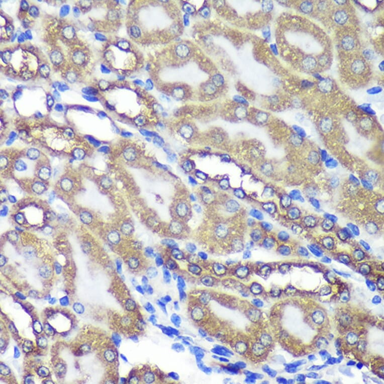Immunohistochemistry - Anti-ANKLE2 Antibody (A305517) - Antibodies.com