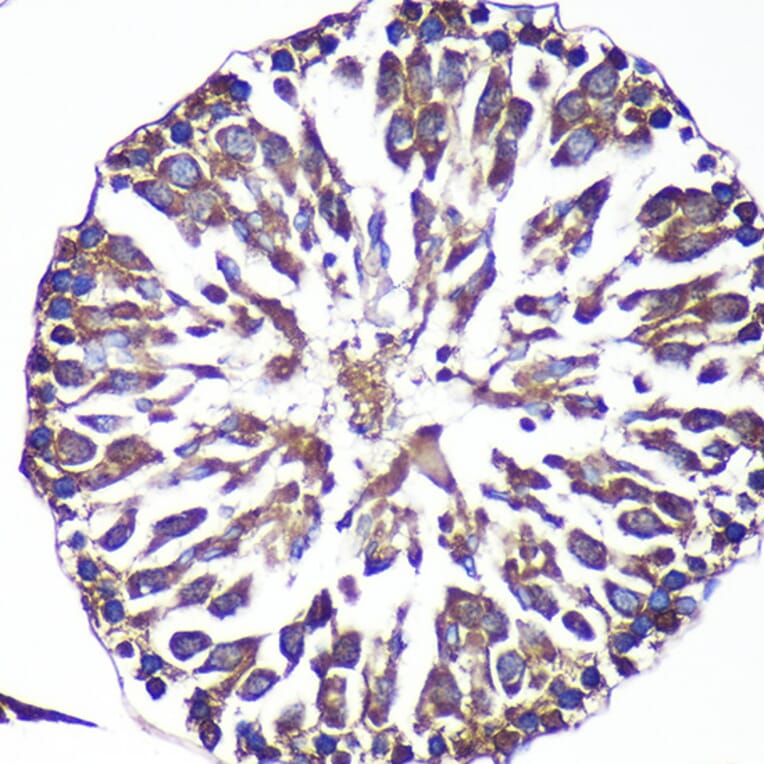 Immunohistochemistry - Anti-ANKLE2 Antibody (A305517) - Antibodies.com