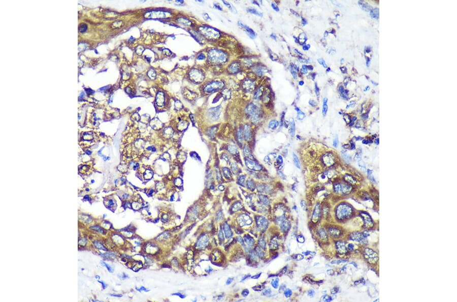 Immunohistochemistry - Anti-ANKLE2 Antibody (A305517) - Antibodies.com