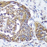 Immunohistochemistry - Anti-ANKLE2 Antibody (A305517) - Antibodies.com