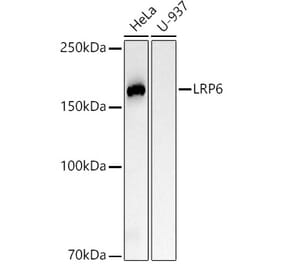 Western Blot - Anti-LRP6 Antibody [ARC54062] (A305519) - Antibodies.com