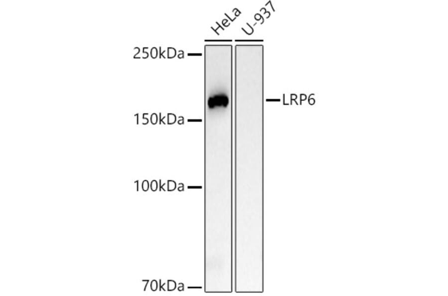 Western Blot - Anti-LRP6 Antibody [ARC54062] (A305519) - Antibodies.com