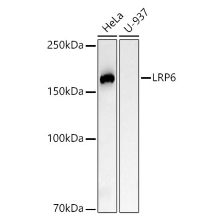 Western Blot - Anti-LRP6 Antibody [ARC54062] (A305519) - Antibodies.com
