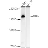 Western Blot - Anti-LRP6 Antibody [ARC54062] (A305519) - Antibodies.com