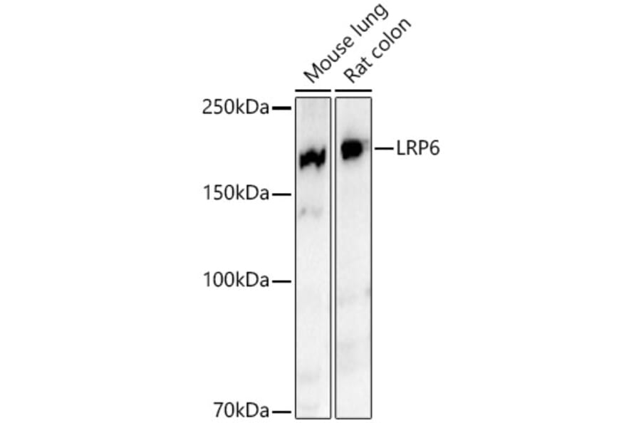 Western Blot - Anti-LRP6 Antibody [ARC54062] (A305519) - Antibodies.com