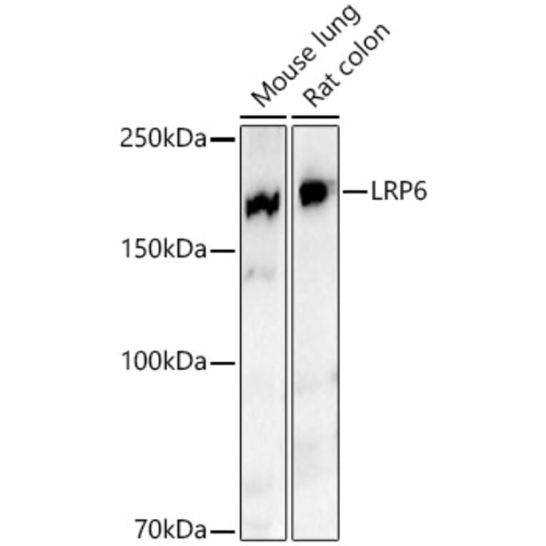 Western Blot - Anti-LRP6 Antibody [ARC54062] (A305519) - Antibodies.com