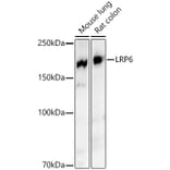 Western Blot - Anti-LRP6 Antibody [ARC54062] (A305519) - Antibodies.com