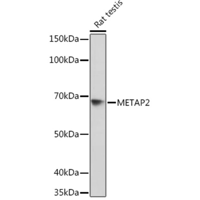 Western Blot - Anti-Methionine Aminopeptidase 2/p67 Antibody [ARC2022] (A305520) - Antibodies.com