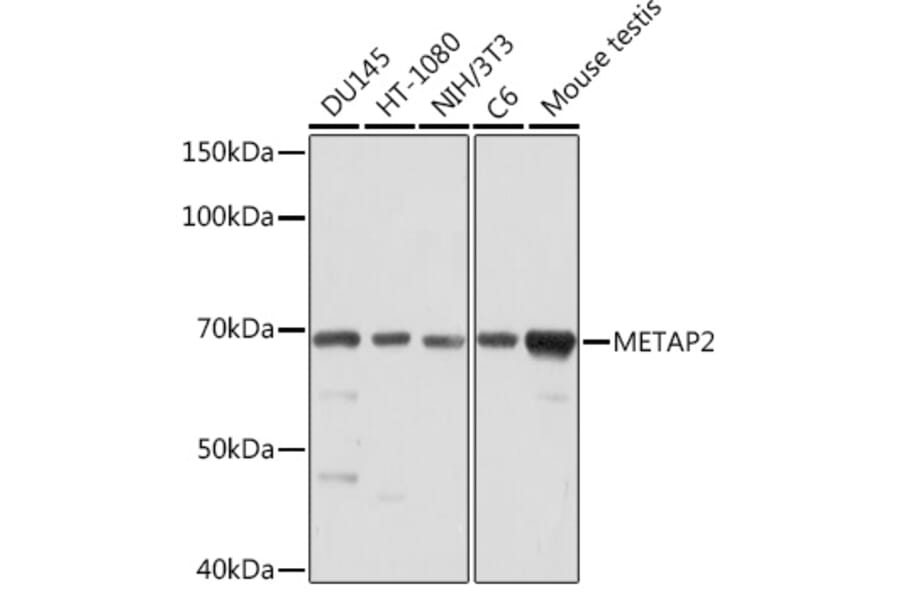 Western Blot - Anti-Methionine Aminopeptidase 2/p67 Antibody [ARC2022] (A305520) - Antibodies.com