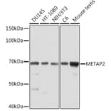 Western Blot - Anti-Methionine Aminopeptidase 2/p67 Antibody [ARC2022] (A305520) - Antibodies.com