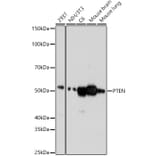 Western Blot - Anti-PTEN Antibody [ARC0364] (A305521) - Antibodies.com