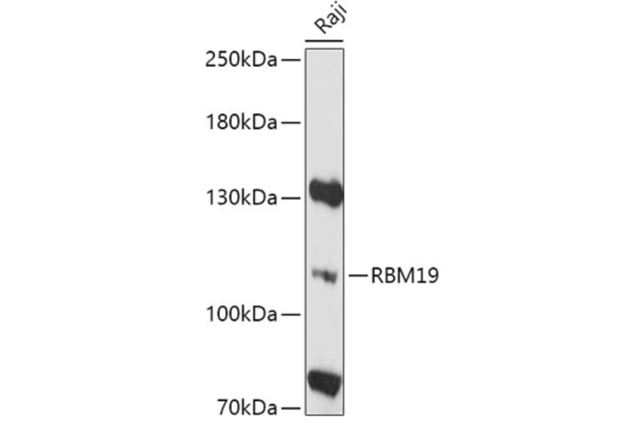 Western Blot - Anti-RBM19 Antibody (A305522) - Antibodies.com