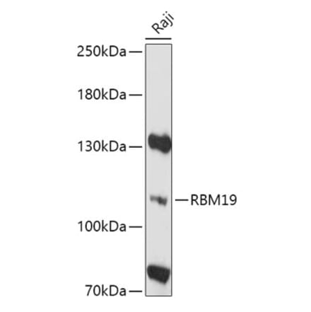 Western Blot - Anti-RBM19 Antibody (A305522) - Antibodies.com