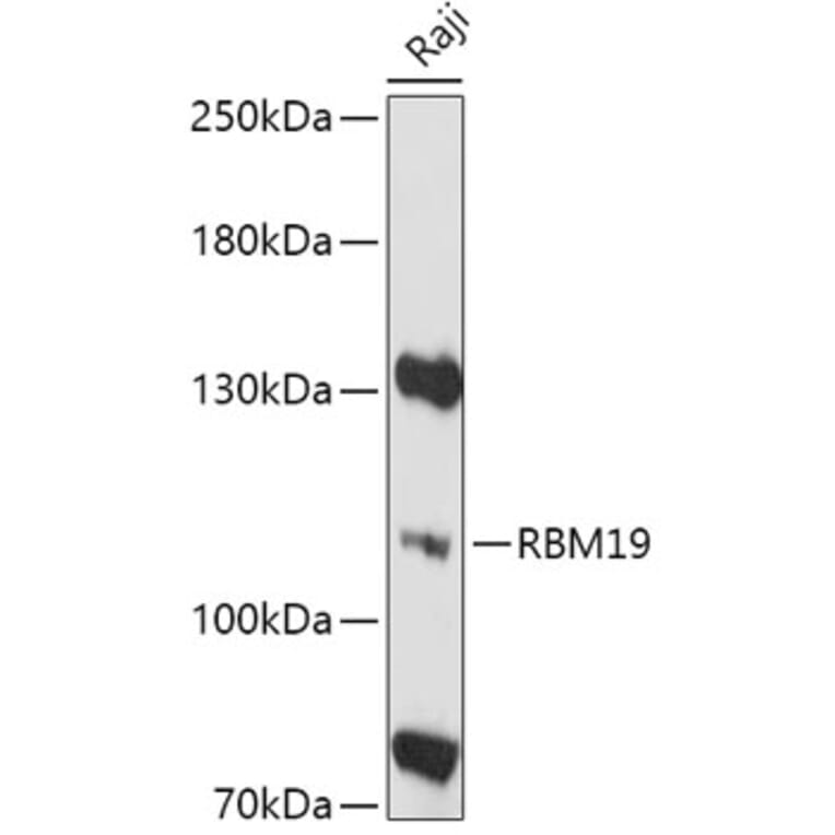 Western Blot - Anti-RBM19 Antibody (A305522) - Antibodies.com
