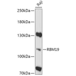 Western Blot - Anti-RBM19 Antibody (A305522) - Antibodies.com