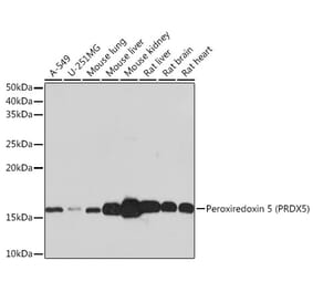 Western Blot - Anti-Peroxiredoxin 5 Antibody [ARC0873] (A305523) - Antibodies.com