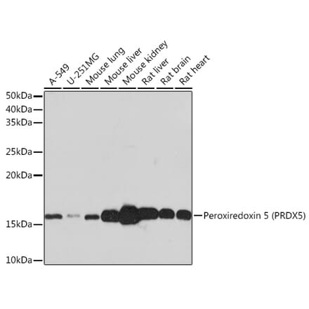 Western Blot - Anti-Peroxiredoxin 5 Antibody [ARC0873] (A305523) - Antibodies.com