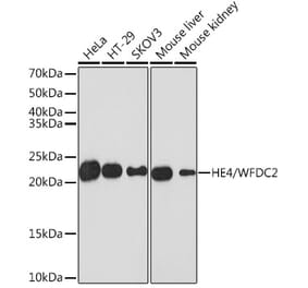 Western Blot - Anti-HE4 Antibody [ARC1936] (A305524) - Antibodies.com