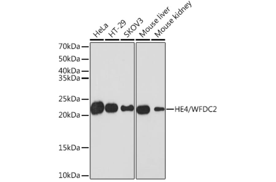 Western Blot - Anti-HE4 Antibody [ARC1936] (A305524) - Antibodies.com