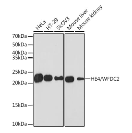 Western Blot - Anti-HE4 Antibody [ARC1936] (A305524) - Antibodies.com