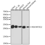 Western Blot - Anti-HE4 Antibody [ARC1936] (A305524) - Antibodies.com