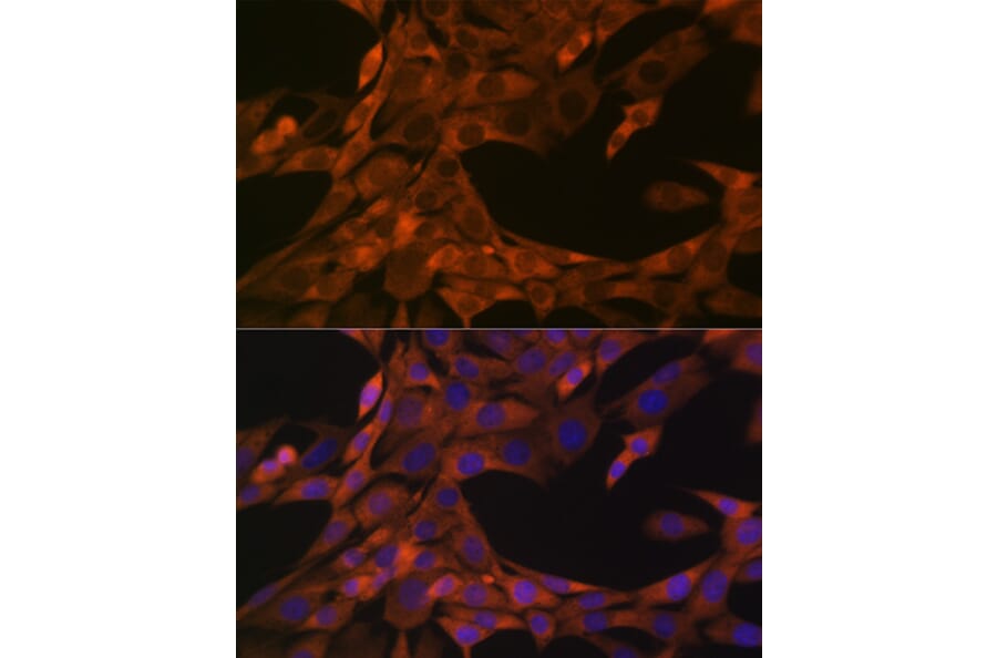 Immunofluorescence - Anti-HE4 Antibody [ARC1936] (A305524) - Antibodies.com